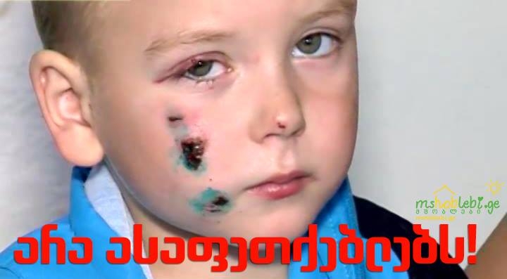 შემოგვიერთდით! ჩვენ ვიწყებთ ბრძოლას ასაფეთქებლების წინააღმდეგ! mshoblebi