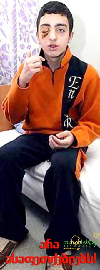 შემოგვიერთდით! ჩვენ ვიწყებთ ბრძოლას ასაფეთქებლების წინააღმდეგ! mshoblebi