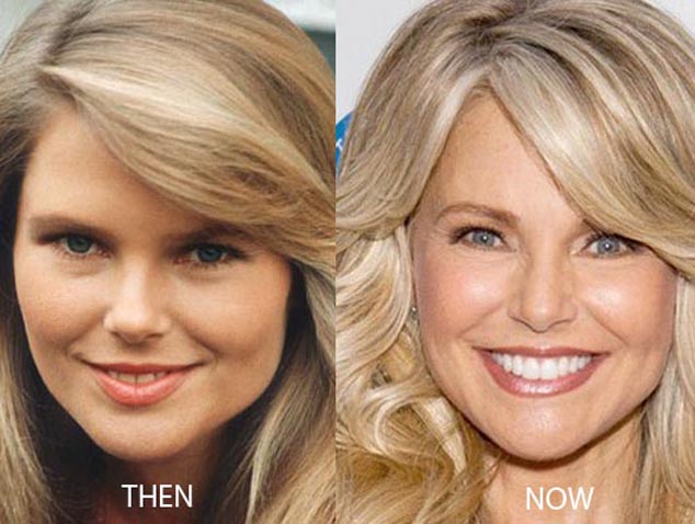 christie-brinkley-plastic-surgery-1710839464.jpg
